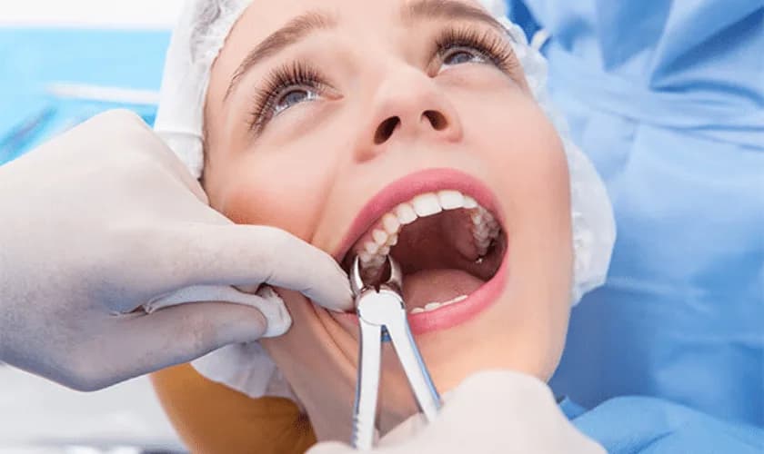 Teeth Extractions